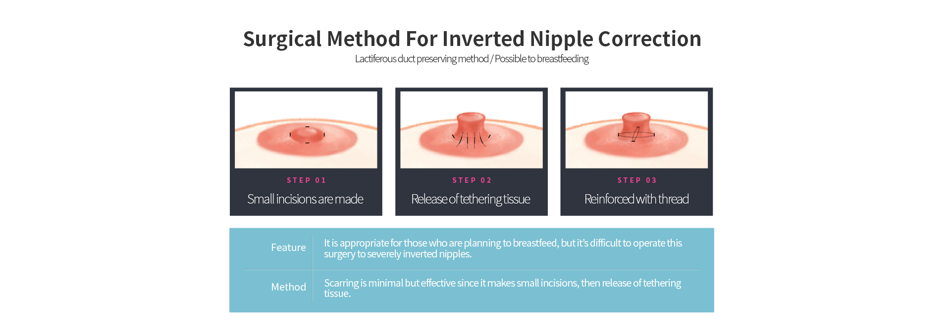Surgical Method For Inverted Nipple Correction, step 1. Small incisions are made, step 2. Release of tethering tissue, step 3. Reinforced with thread