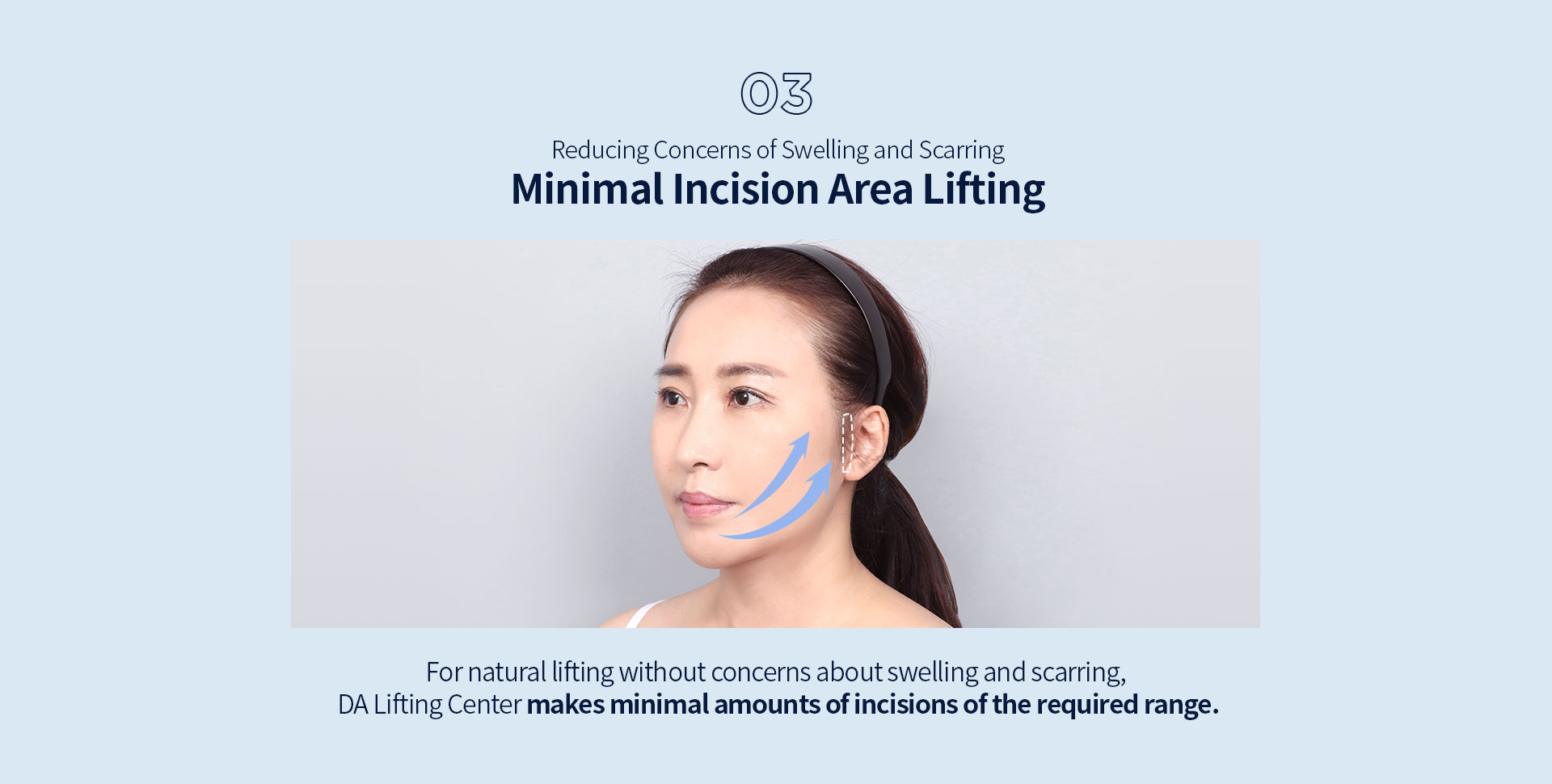03. Reducing puffiness and minimizing scarring. Small area incision lifting