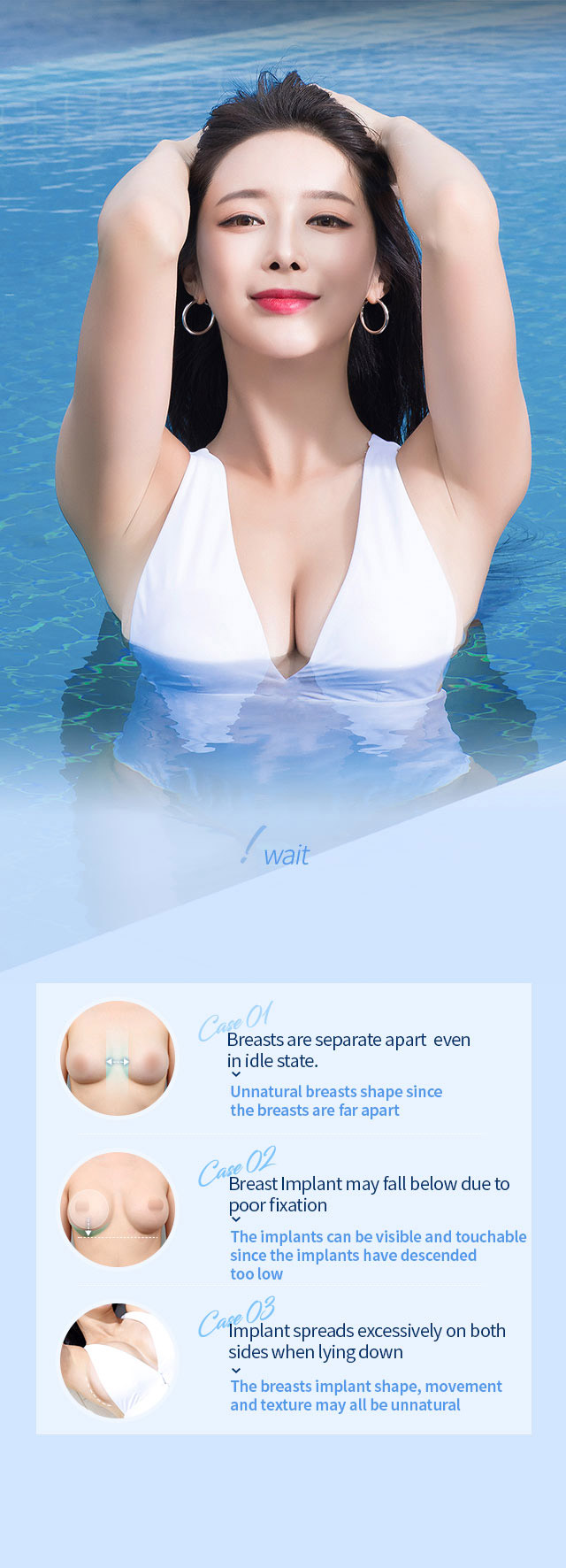 WDA Natural Cleavage Breast Augmentation