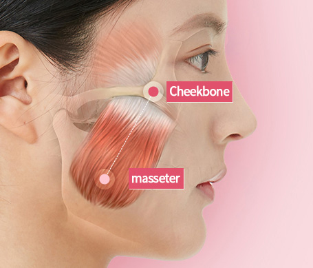 cheekbone is tightly connected with masseter muscle that is used when chewing