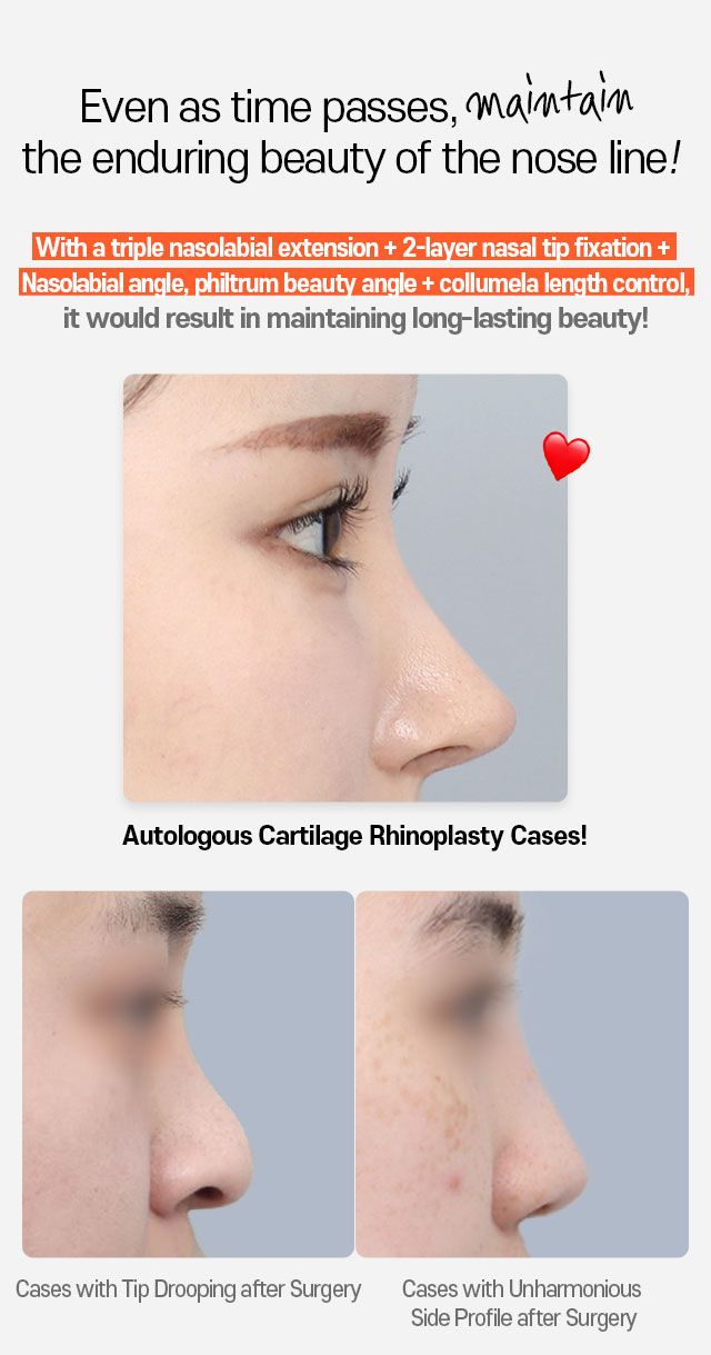 Autologous Cartilage Rhinoplasty