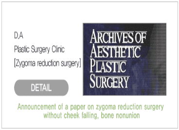 Zygoma reduction surgery