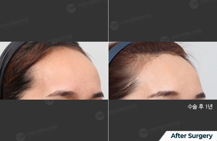 45°