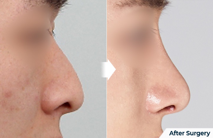 side
