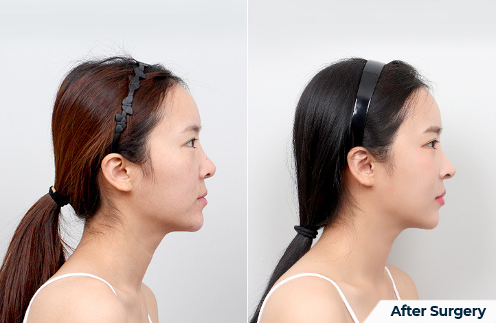 side