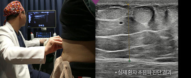 Ultrasound Diagnosis