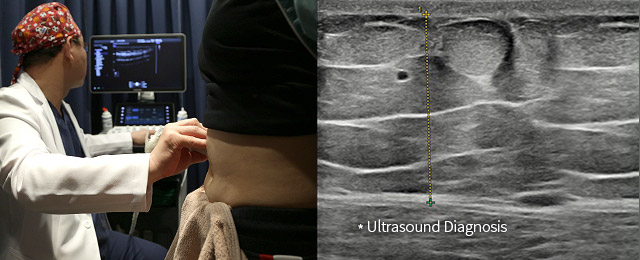 Ultrasound Diagnosis