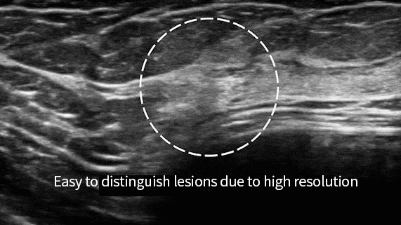 DA’s high resolution ultrasound device