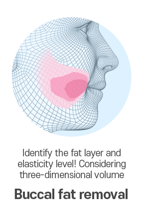 3-Point Facial Contouring