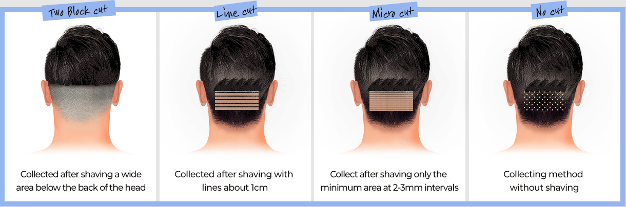 Non-incision (Occipital) Hair Cutting Method