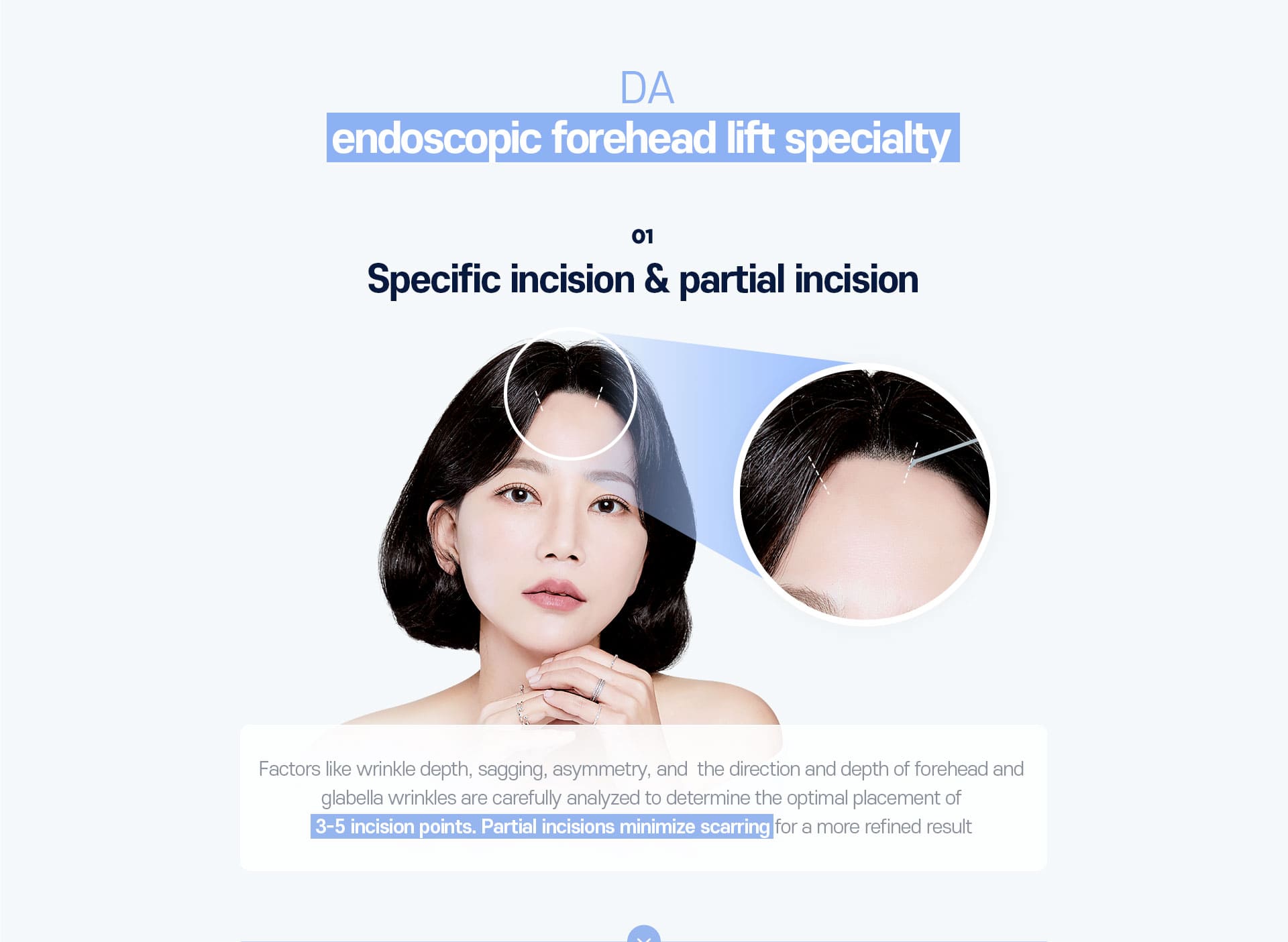 DA Endoscopic Forehead Lift