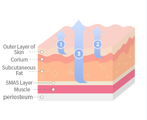 Lifting With the SMAS Layer image
