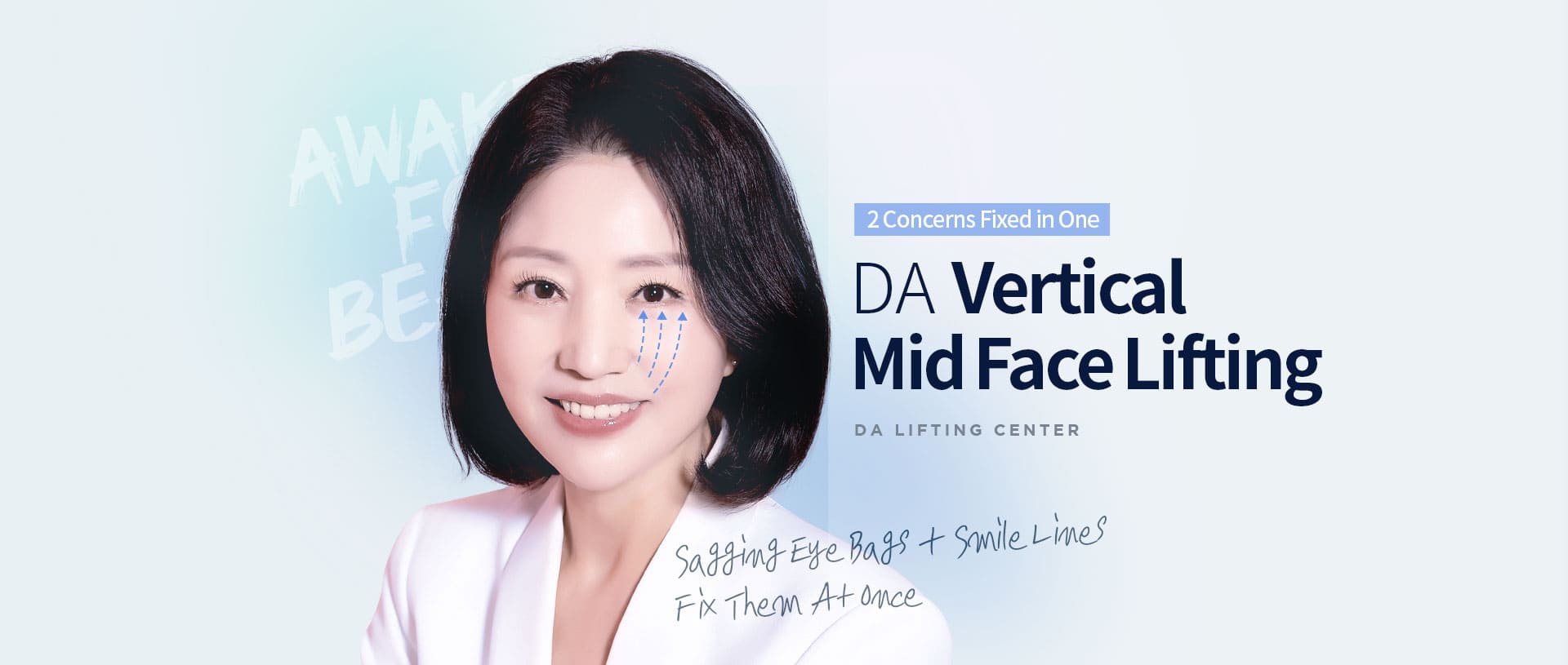 DA Vertical Mid Face Lifting