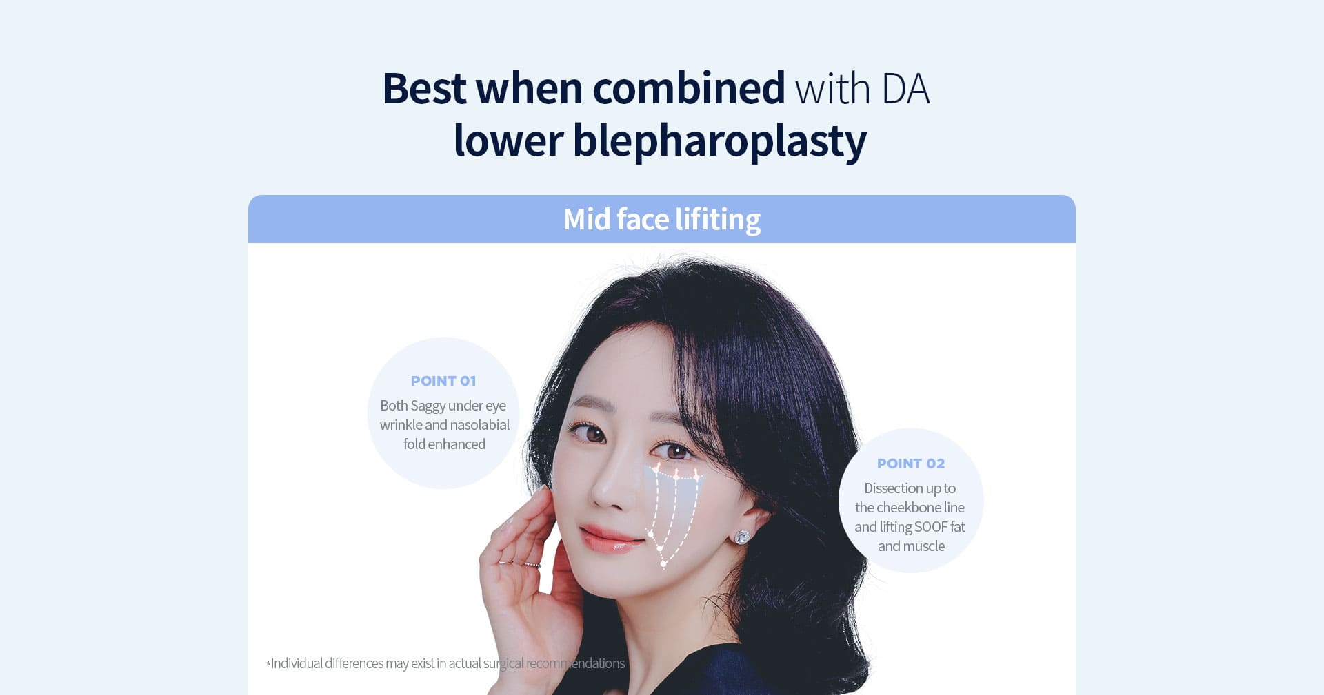 DA lower blepharoplasty