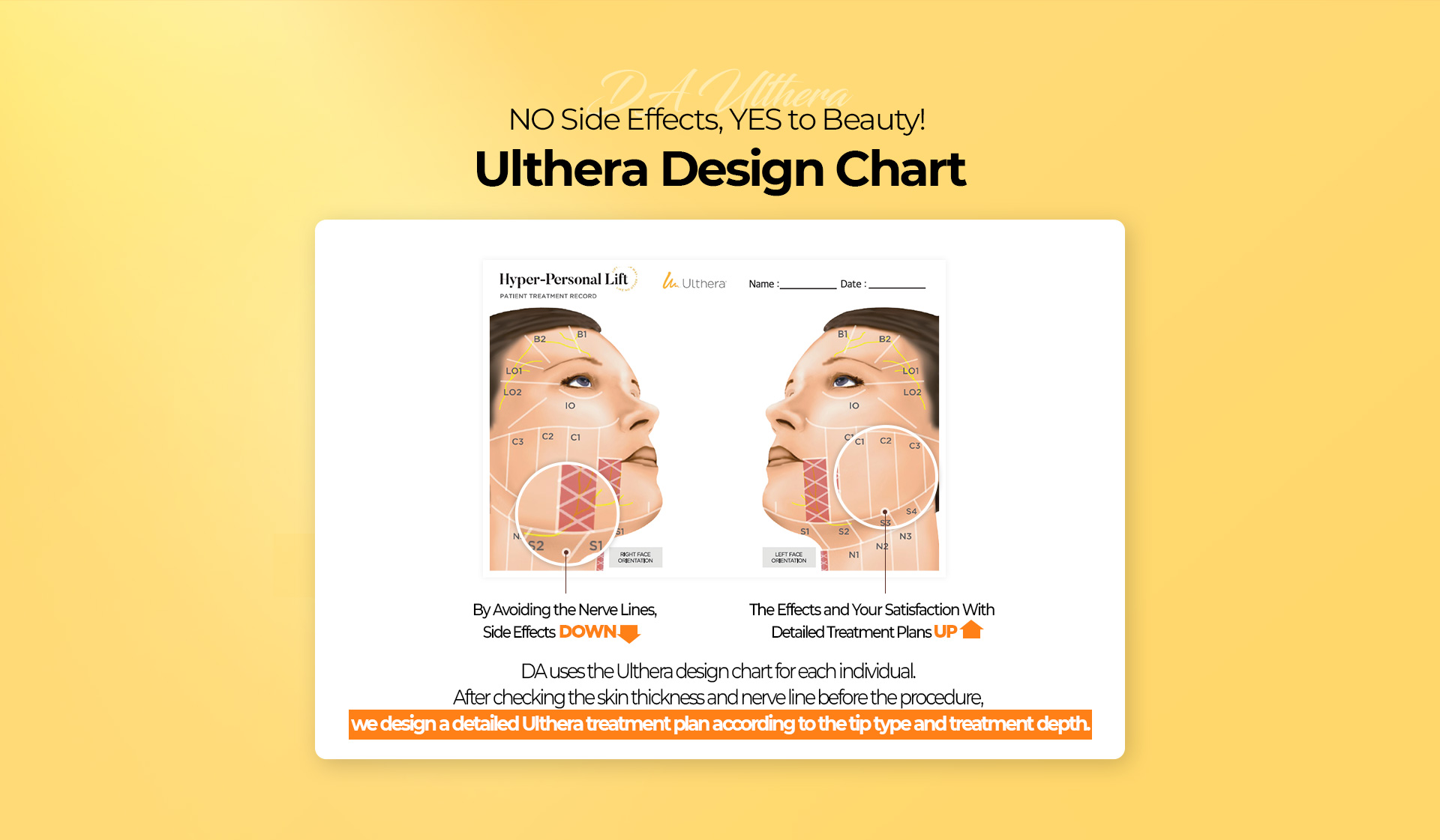 ulthera design chart