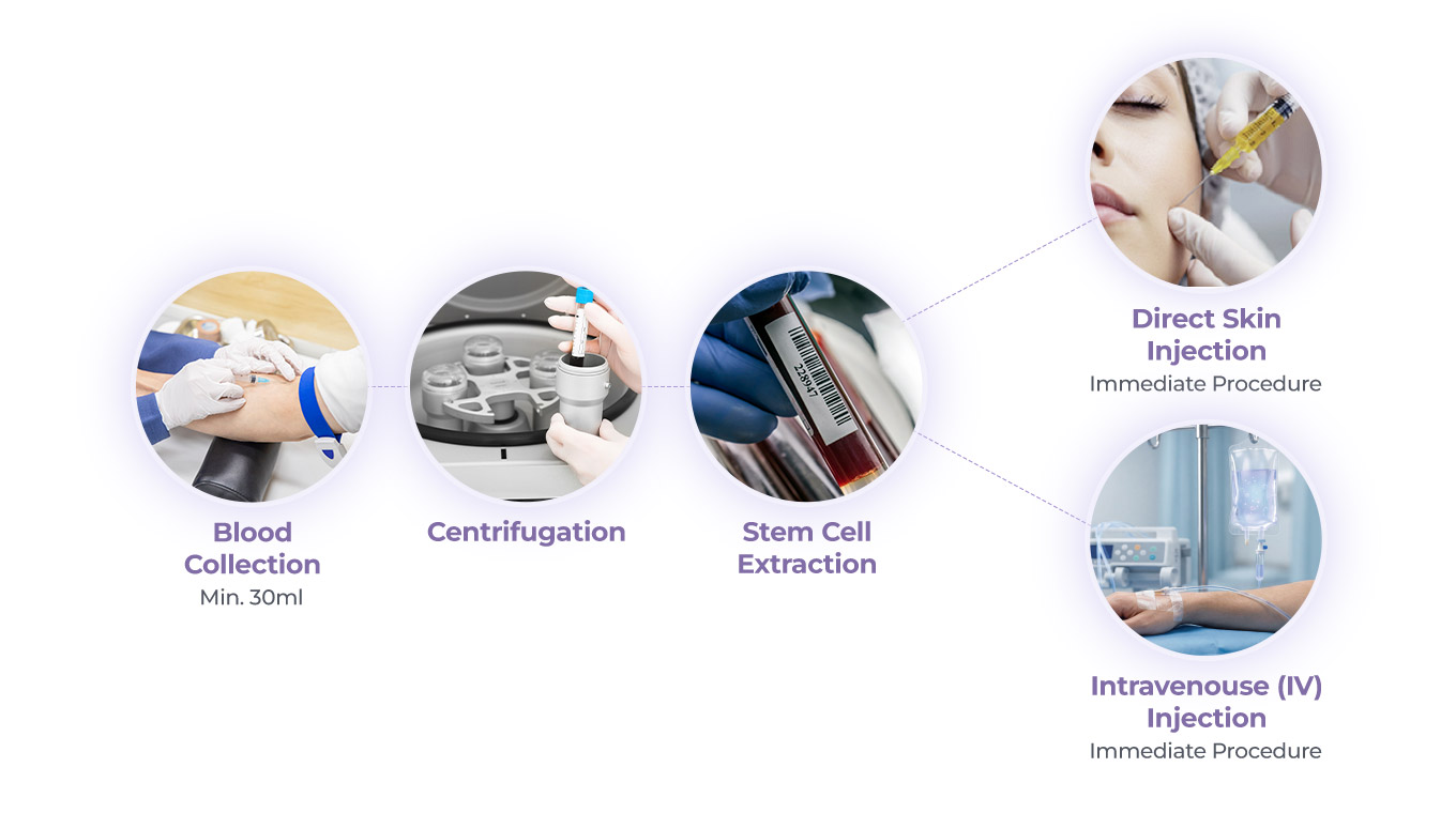 The processes of DA Blood-Derived Stem Cell Therapy