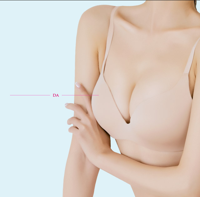 DA Fat Transfer Breast Augmentation