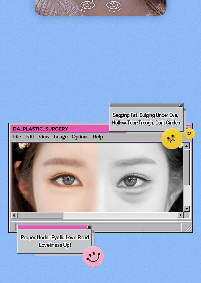 DA Under Eye Fat Repositioning