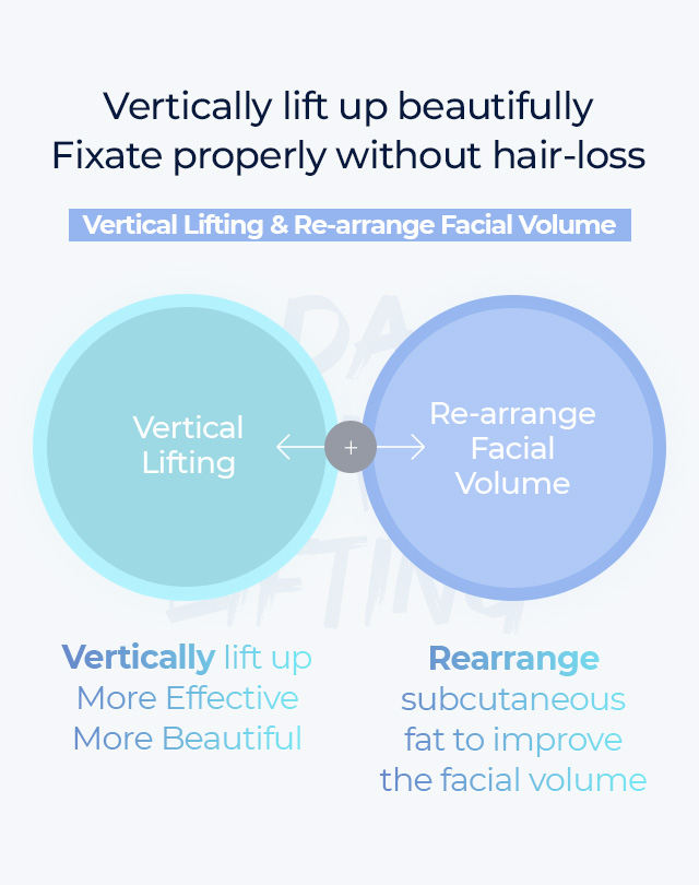 Vertically lift up beautifully Fixate properly without hair-loss