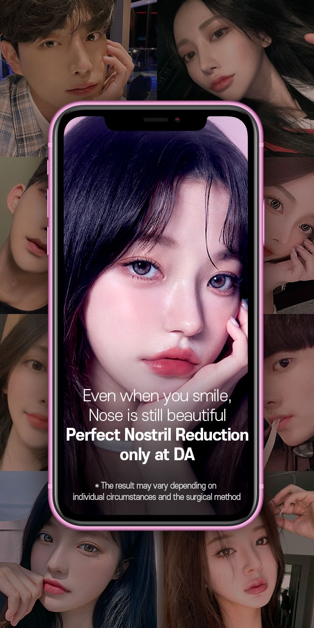 Even when you smile, Nose is still beautiful Perfect Nostril Reduction only at DA