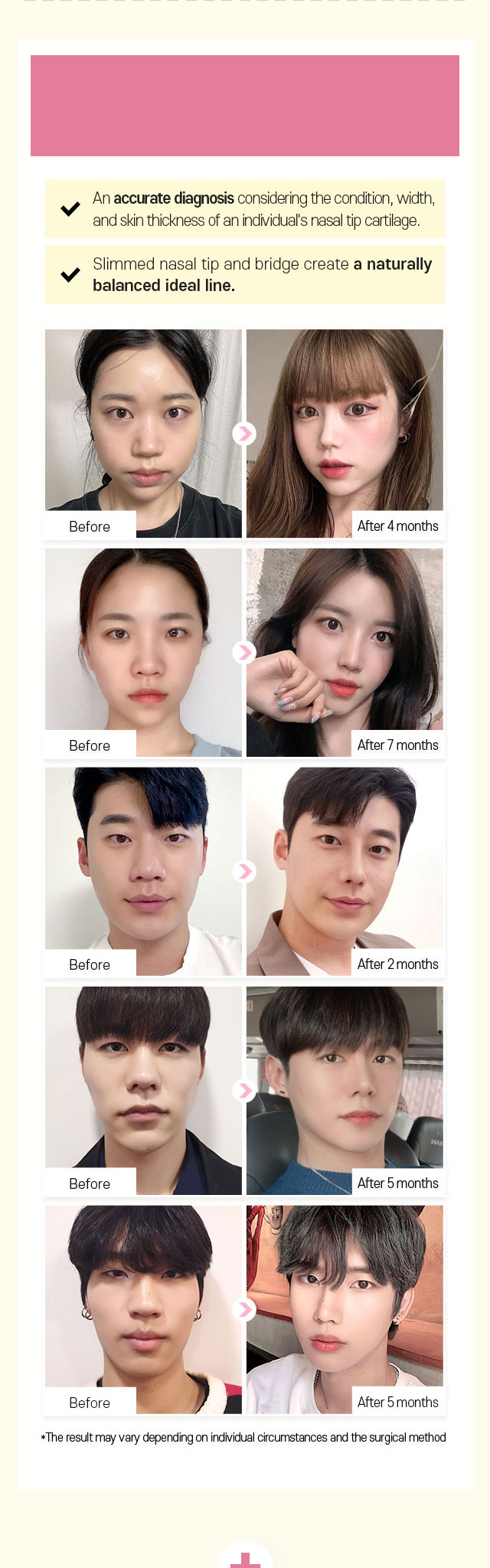 DA Bulbous Nose Correction