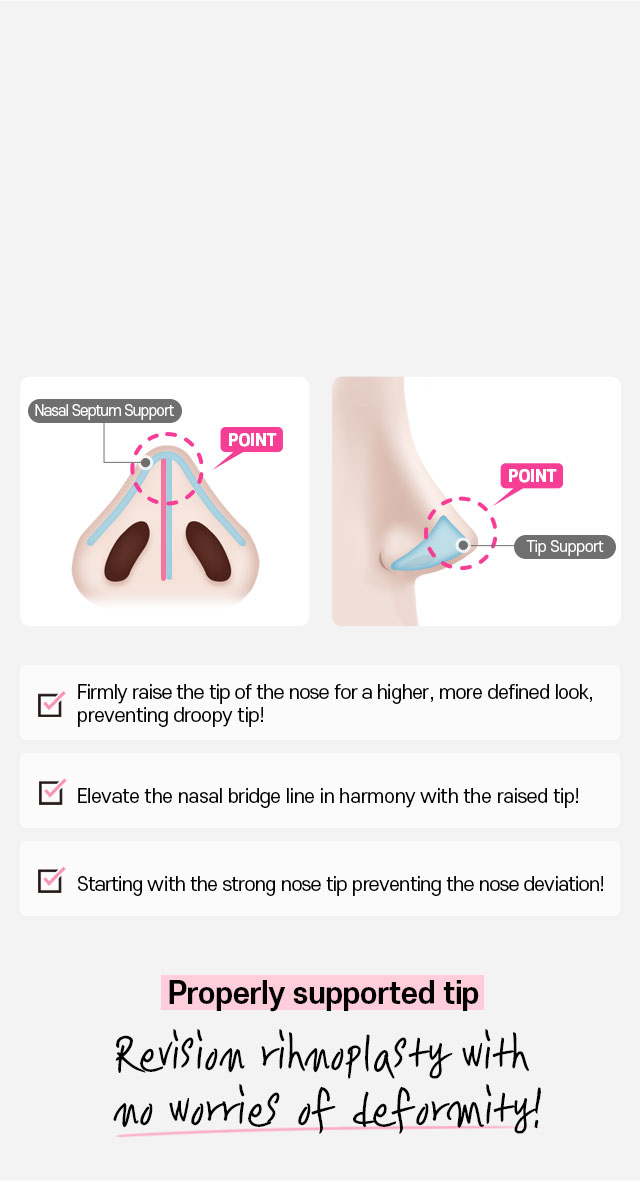 DA Revision Rhinoplasty